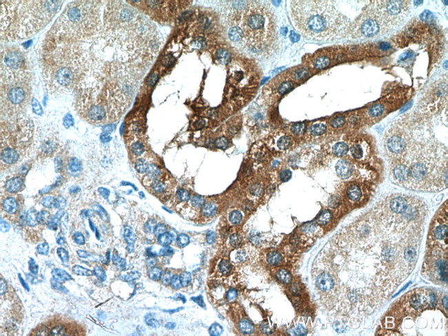 Cystatin C Antibody in Immunohistochemistry (Paraffin) (IHC (P))