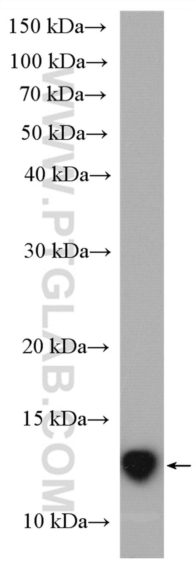 Cystatin C Antibody in Western Blot (WB)