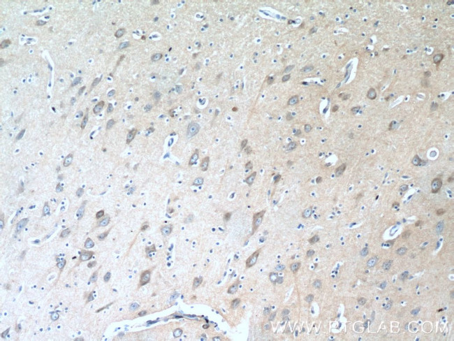 TAGLN3 Antibody in Immunohistochemistry (Paraffin) (IHC (P))