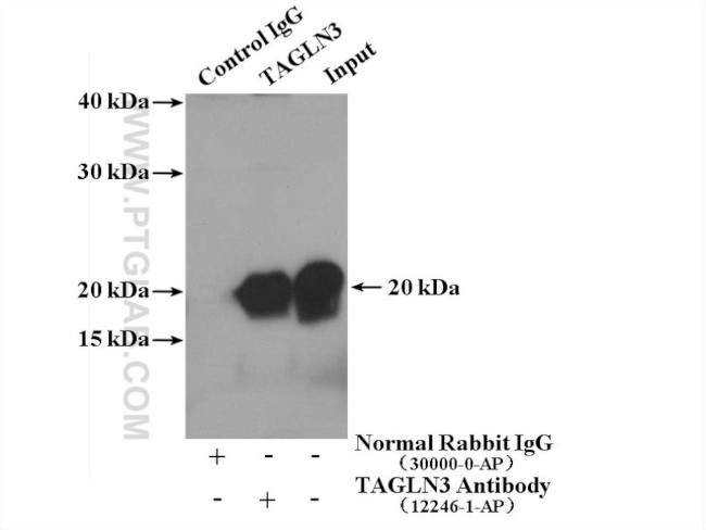 TAGLN3 Antibody in Immunoprecipitation (IP)