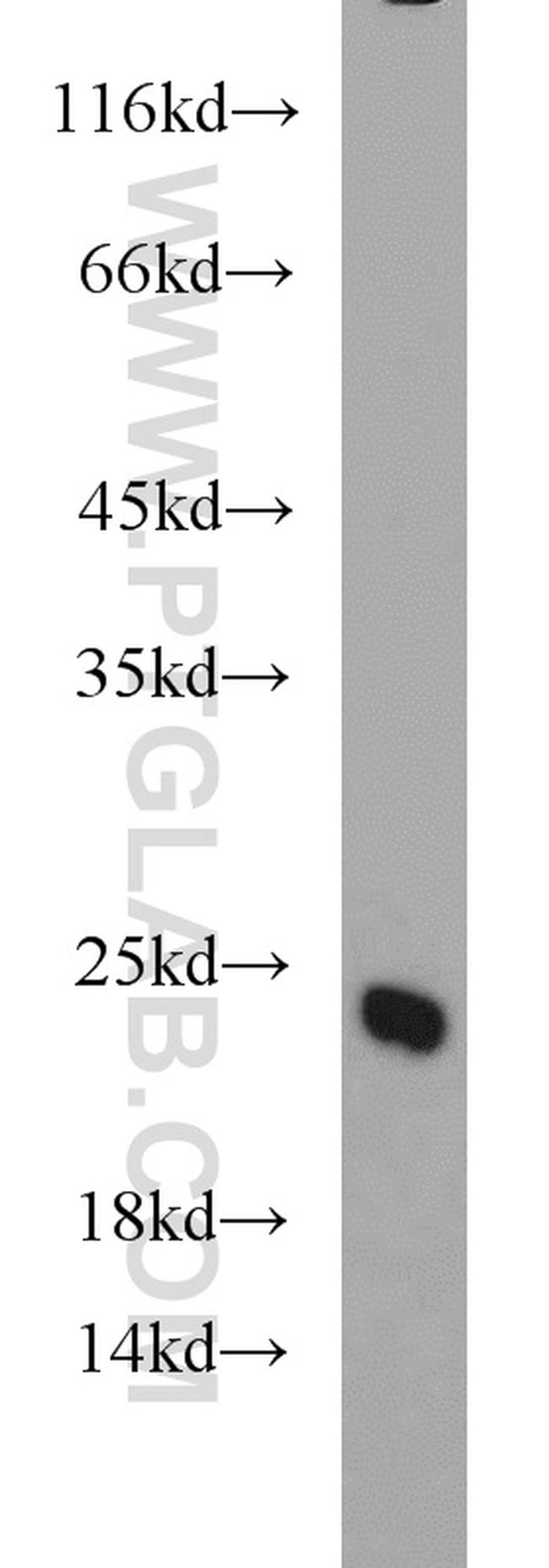 TAGLN3 Antibody in Western Blot (WB)