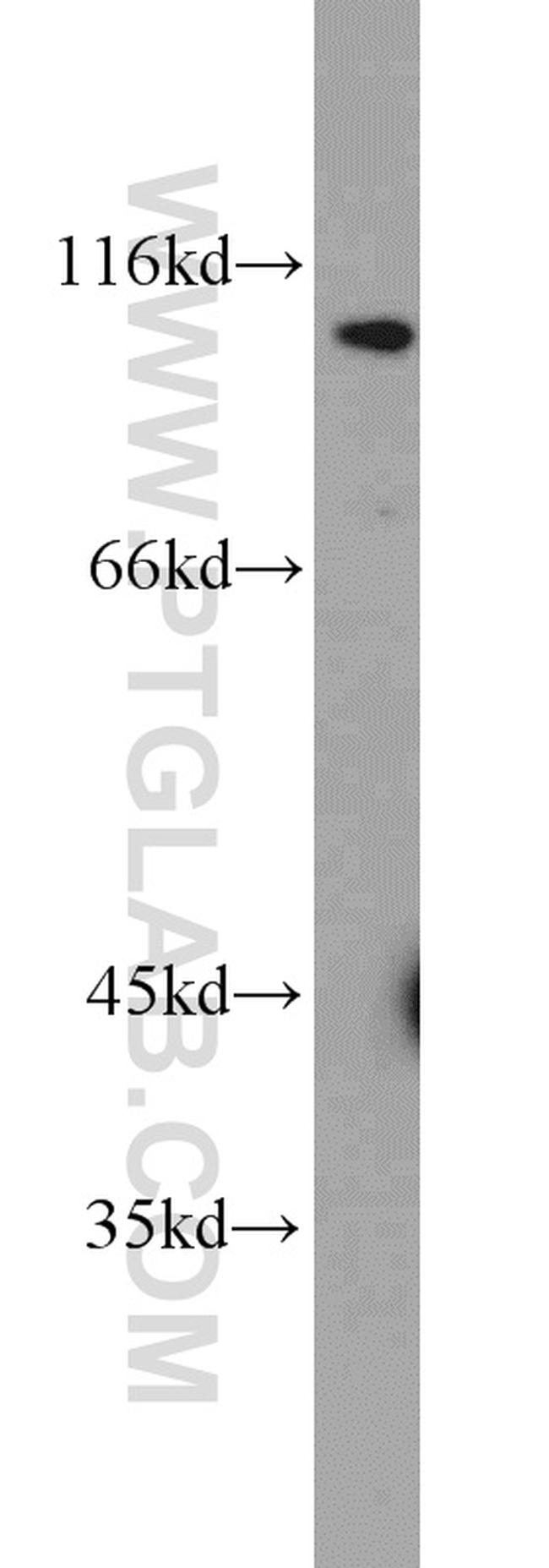 MCM10 Antibody in Western Blot (WB)