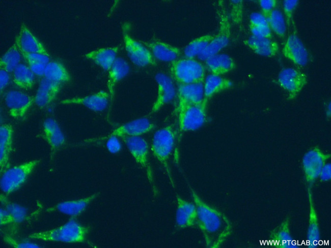 SLC25A11 Antibody in Immunocytochemistry (ICC/IF)