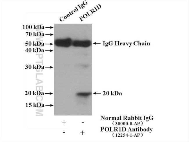 POLR1D Antibody in Immunoprecipitation (IP)