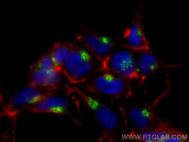 RCAS1 Antibody in Immunocytochemistry (ICC/IF)