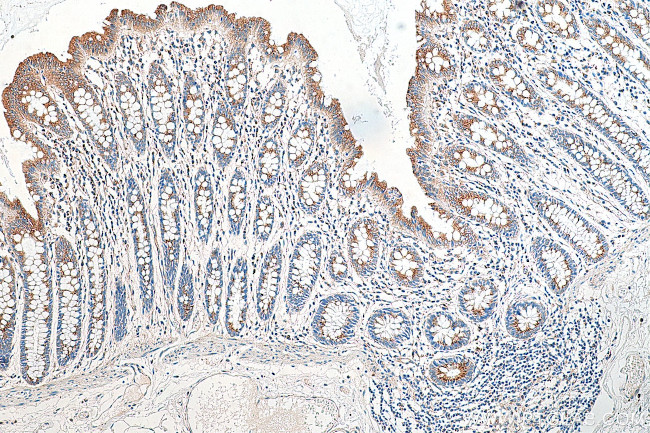 RCAS1 Antibody in Immunohistochemistry (Paraffin) (IHC (P))