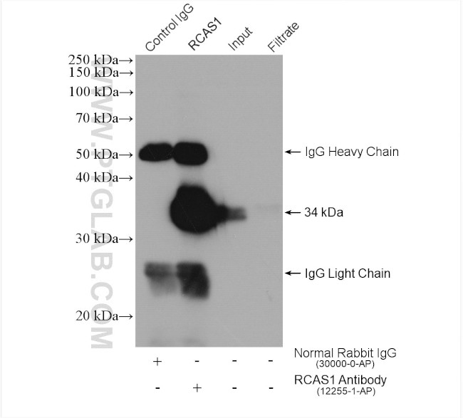 RCAS1 Antibody in Immunoprecipitation (IP)