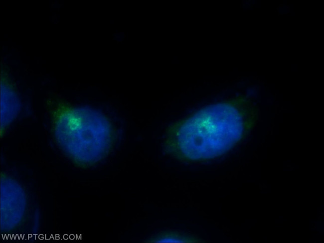 RCAS1 Antibody in Immunocytochemistry (ICC/IF)