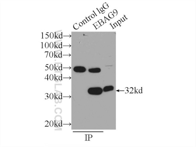 RCAS1 Antibody in Immunoprecipitation (IP)