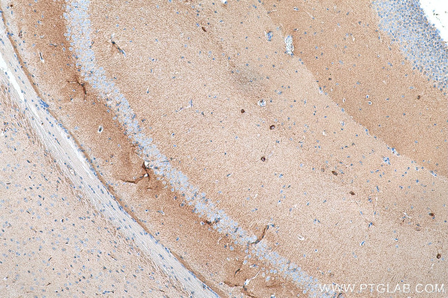 NECAB2 Antibody in Immunohistochemistry (Paraffin) (IHC (P))