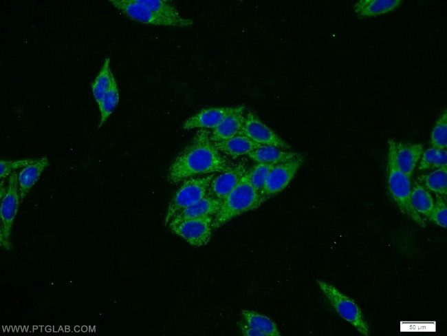 SERPING1/C1 Inactivator Antibody in Immunocytochemistry (ICC/IF)