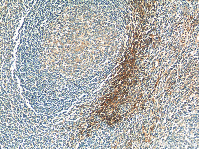 SERPING1/C1 Inactivator Antibody in Immunohistochemistry (Paraffin) (IHC (P))