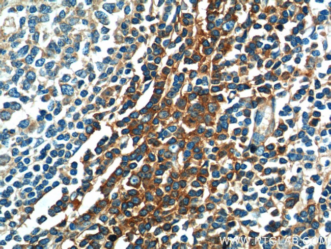 SERPING1/C1 Inactivator Antibody in Immunohistochemistry (Paraffin) (IHC (P))