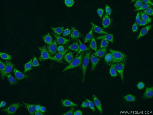 SERPING1/C1 Inactivator Antibody in Immunocytochemistry (ICC/IF)