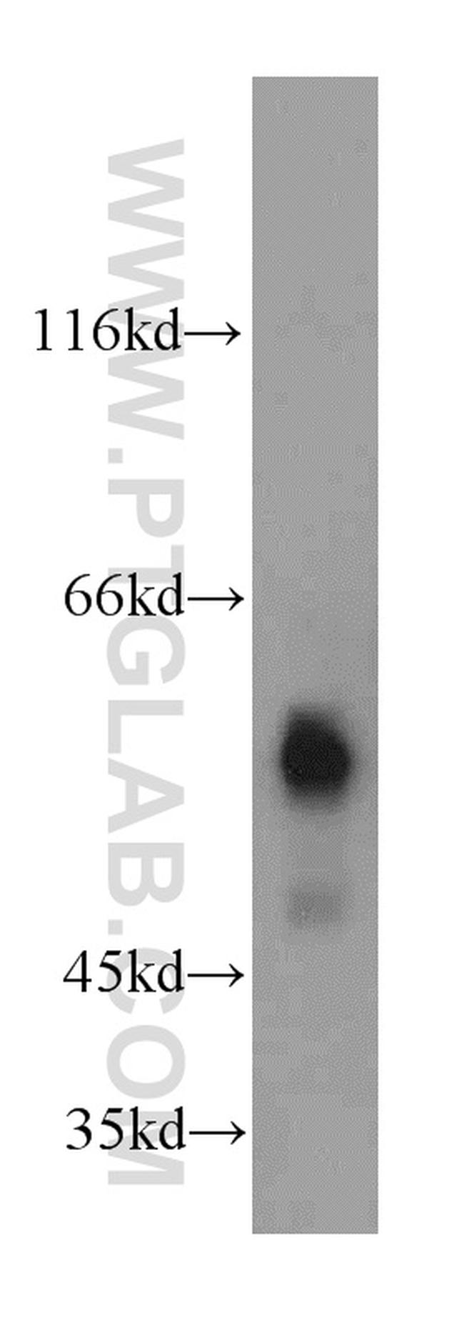 SERPING1/C1 Inactivator Antibody in Western Blot (WB)