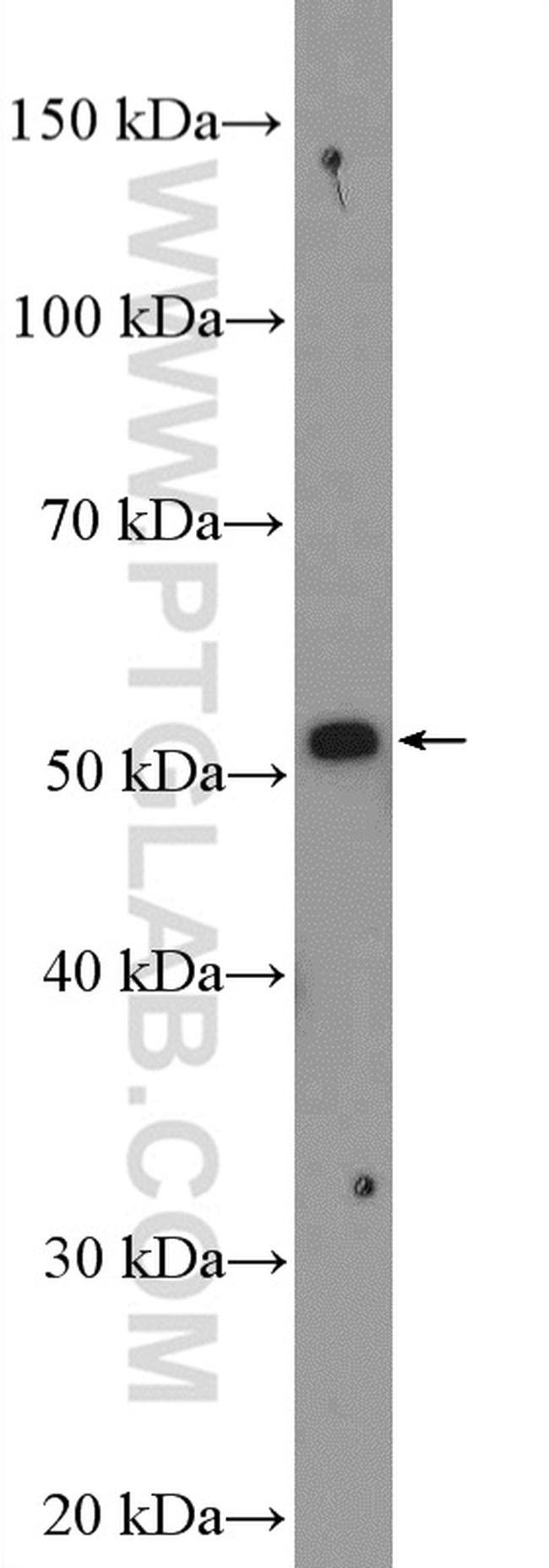 SERPING1/C1 Inactivator Antibody in Western Blot (WB)