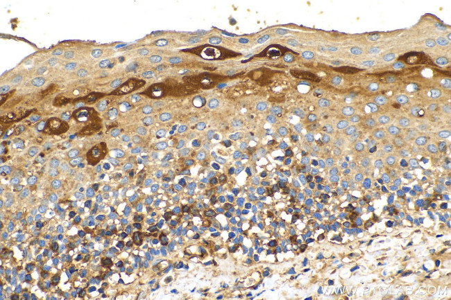 SERPING1/C1 Inactivator Antibody in Immunohistochemistry (Paraffin) (IHC (P))