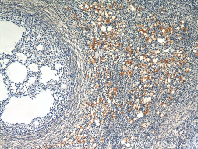 SULF2 Antibody in Immunohistochemistry (Paraffin) (IHC (P))