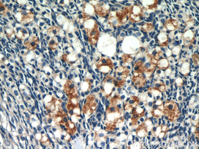 SULF2 Antibody in Immunohistochemistry (Paraffin) (IHC (P))