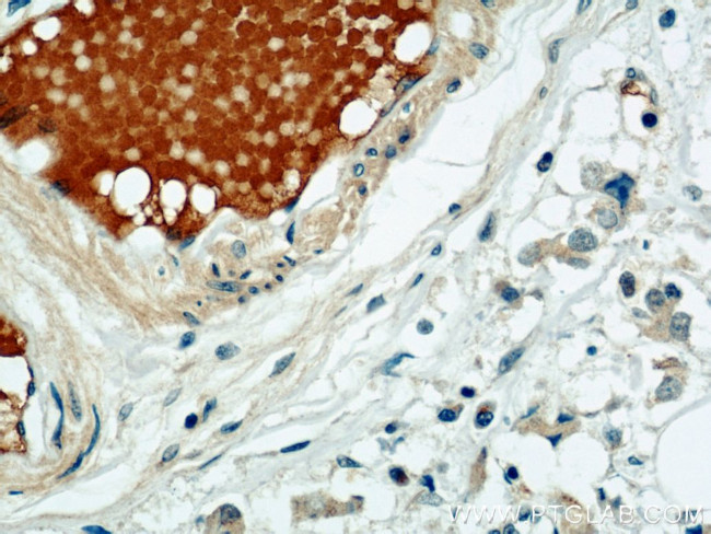 SULF2 Antibody in Immunohistochemistry (Paraffin) (IHC (P))