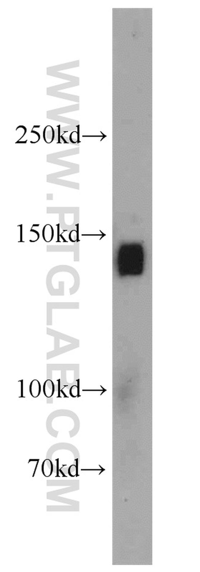 SULF2 Antibody in Western Blot (WB)