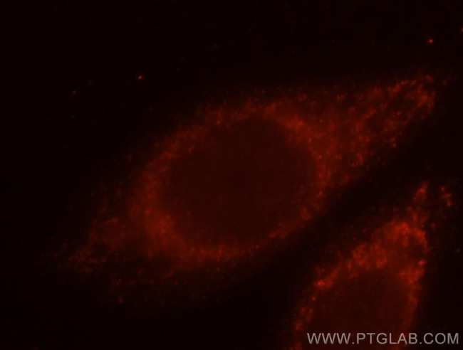 ETFA Antibody in Immunocytochemistry (ICC/IF)