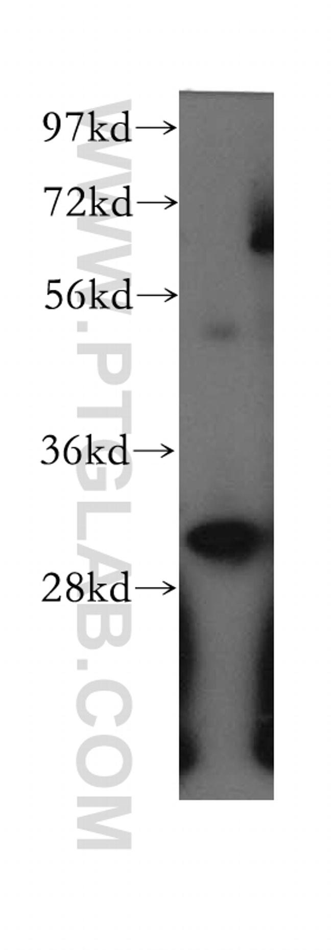 ETFA Antibody in Western Blot (WB)