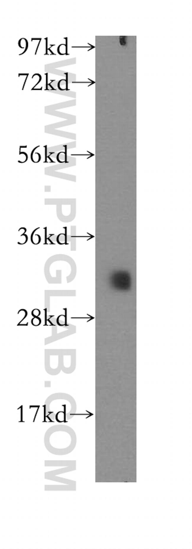 ETFA Antibody in Western Blot (WB)