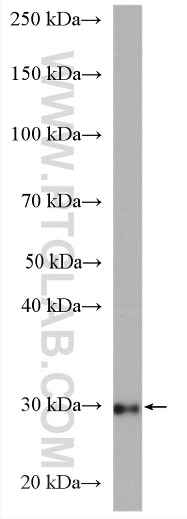 ETFA Antibody in Western Blot (WB)