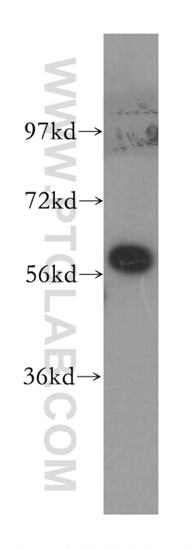 CCT8 Antibody in Western Blot (WB)