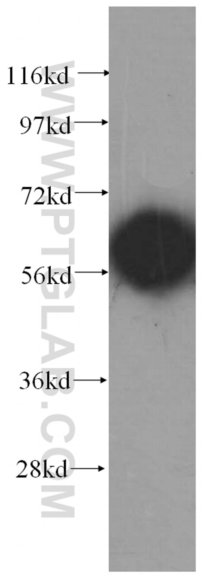 CCT8 Antibody in Western Blot (WB)