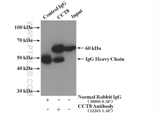 CCT8 Antibody in Immunoprecipitation (IP)