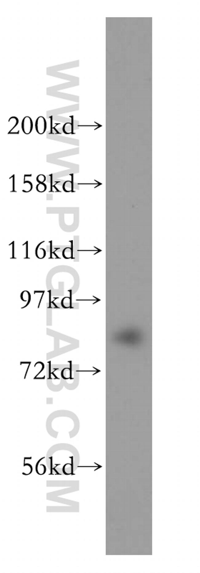 DHX15 Antibody in Western Blot (WB)