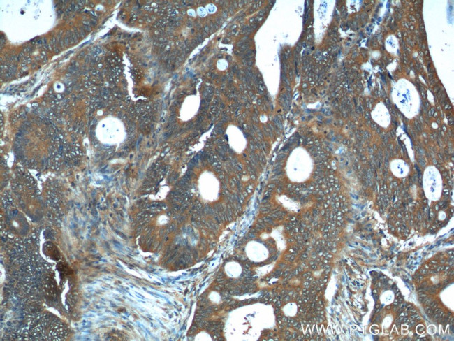 REG4 Antibody in Immunohistochemistry (Paraffin) (IHC (P))