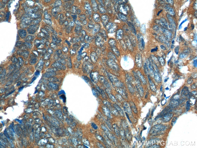 REG4 Antibody in Immunohistochemistry (Paraffin) (IHC (P))