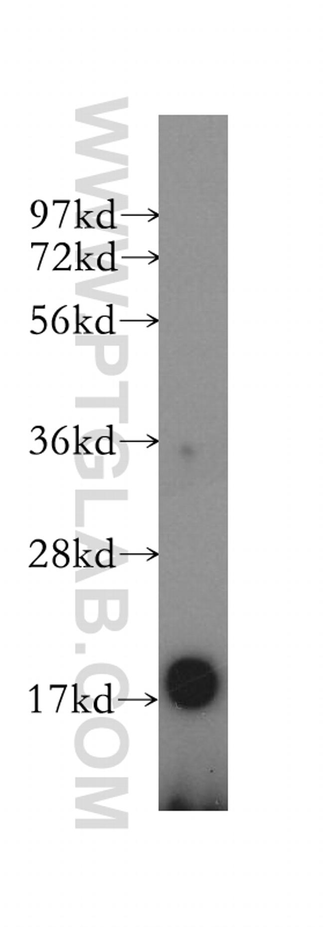 REG4 Antibody in Western Blot (WB)