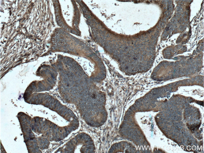 MTHFD2 Antibody in Immunohistochemistry (Paraffin) (IHC (P))