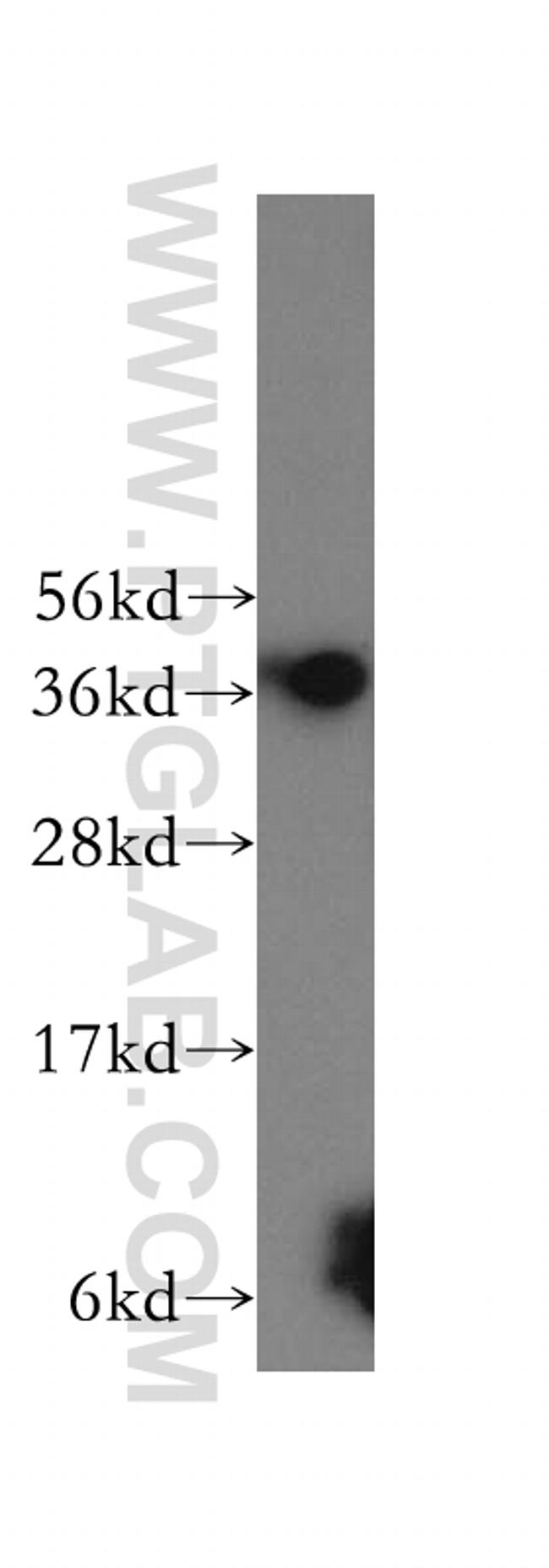 MTHFD2 Antibody in Western Blot (WB)