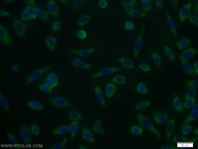 UCK1 Antibody in Immunocytochemistry (ICC/IF)