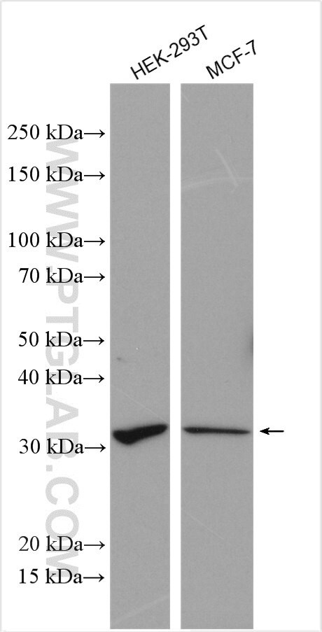 UCK1 Antibody in Western Blot (WB)