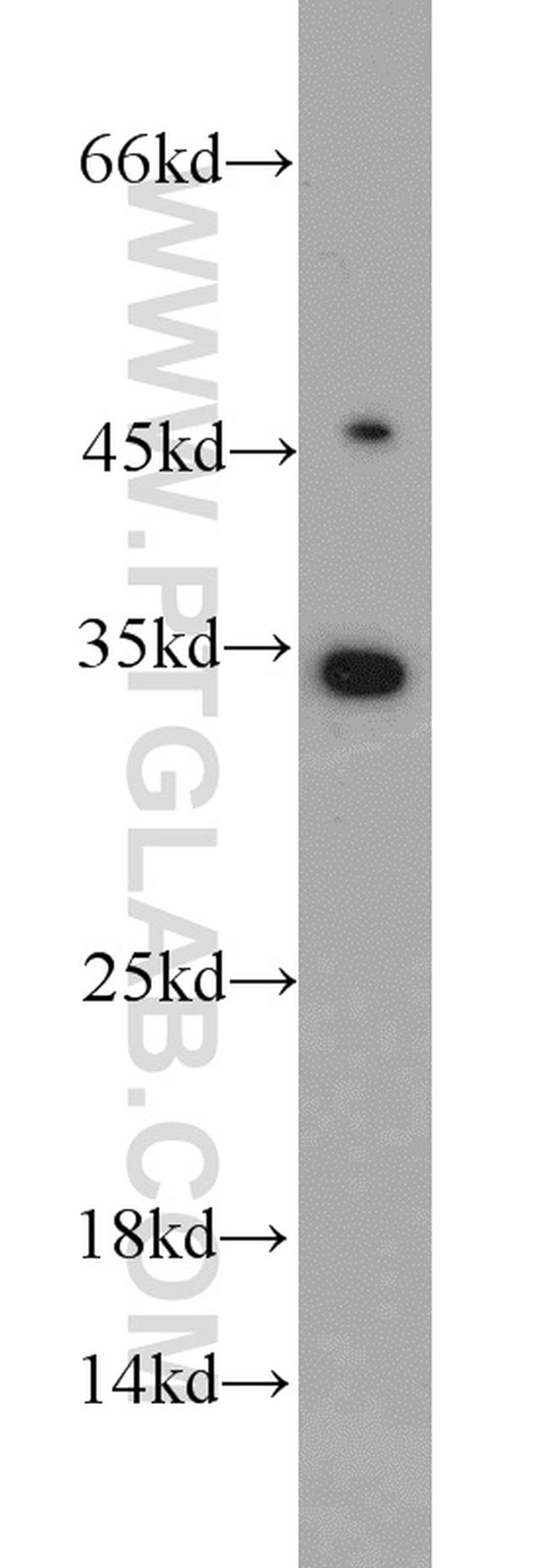 UCK1 Antibody in Western Blot (WB)