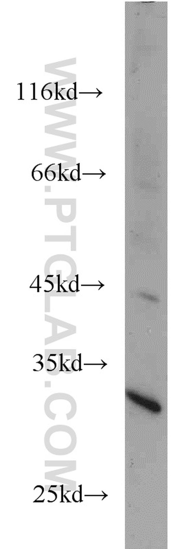 UCK1 Antibody in Western Blot (WB)