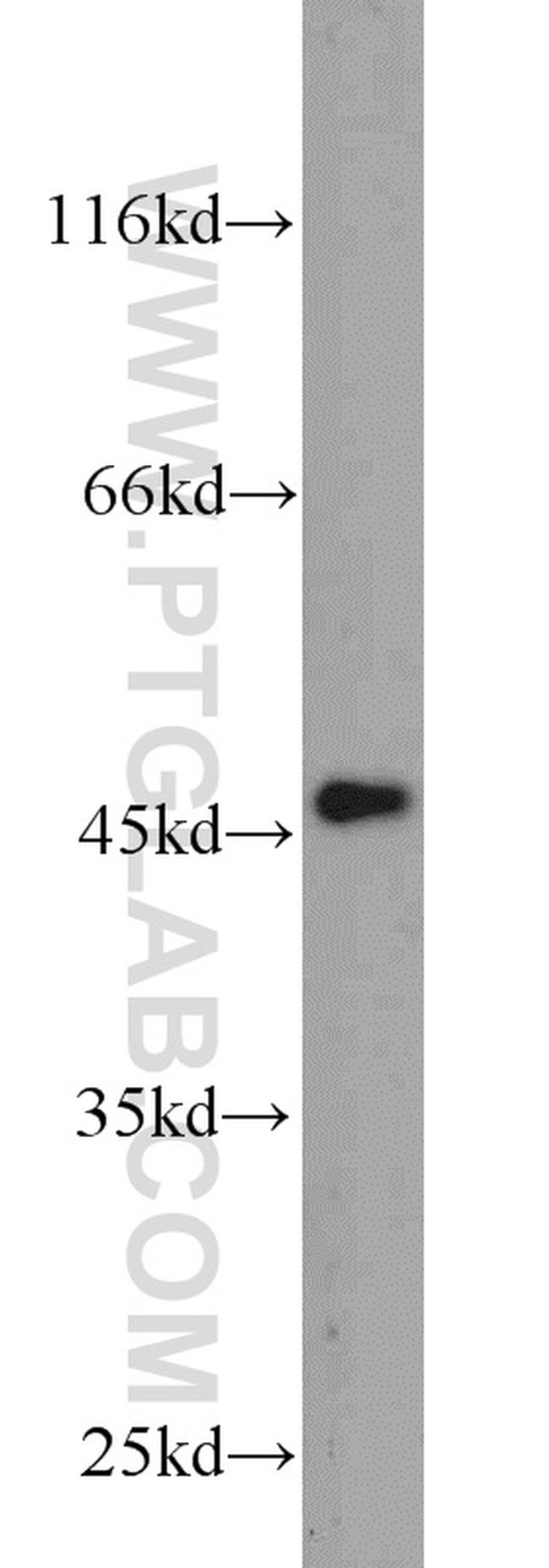 FNTA Antibody in Western Blot (WB)