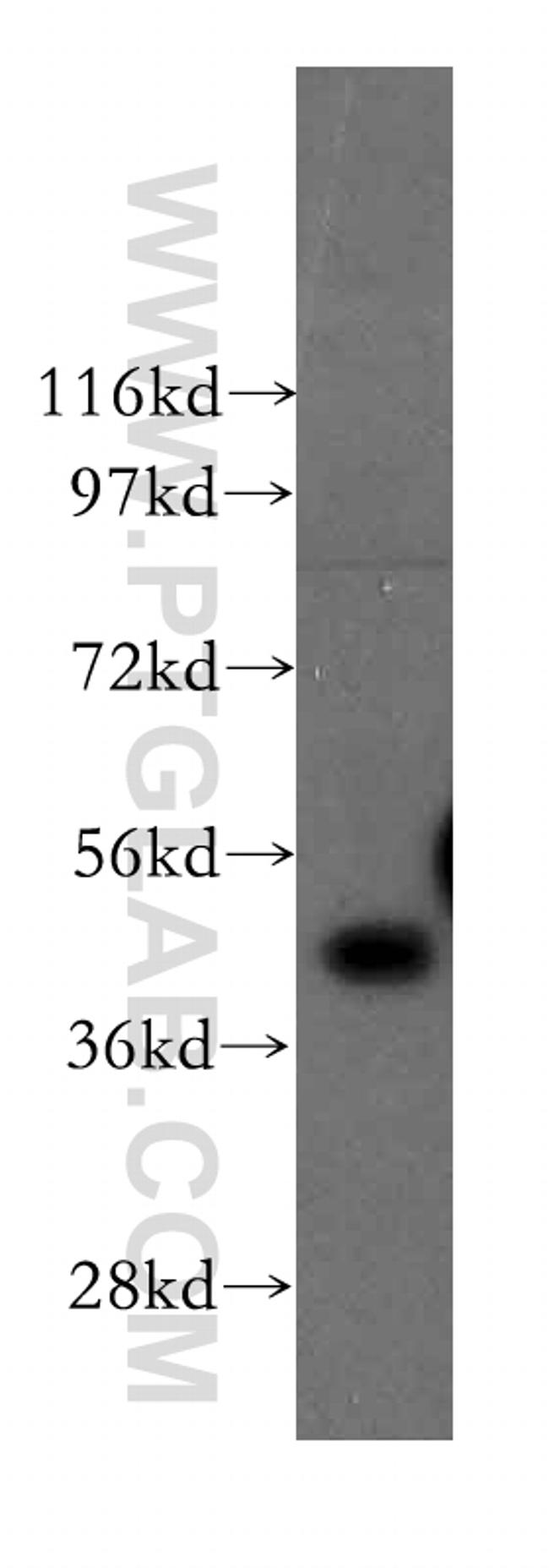 FNTA Antibody in Western Blot (WB)