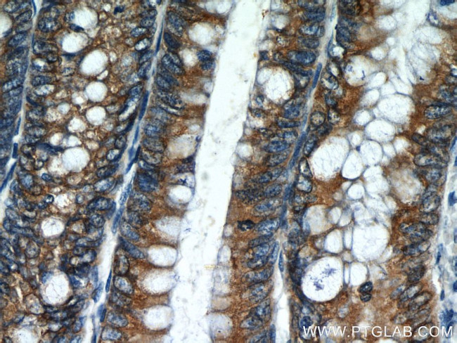 AGR2 Antibody in Immunohistochemistry (Paraffin) (IHC (P))