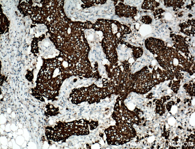 AGR2 Antibody in Immunohistochemistry (Paraffin) (IHC (P))