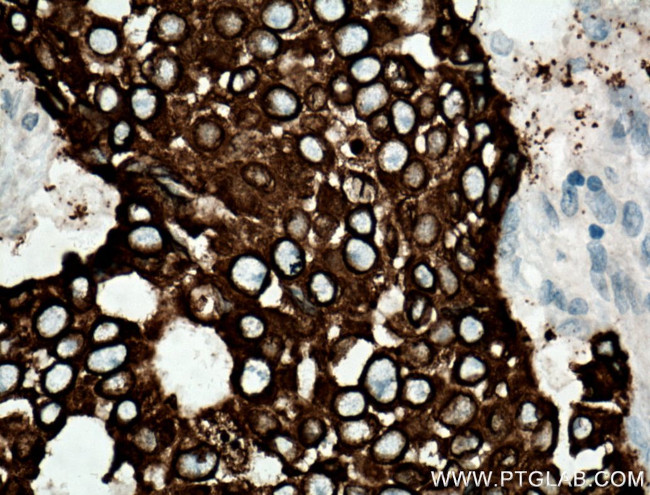 AGR2 Antibody in Immunohistochemistry (Paraffin) (IHC (P))