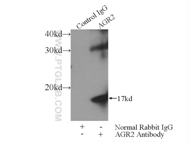 AGR2 Antibody in Immunoprecipitation (IP)