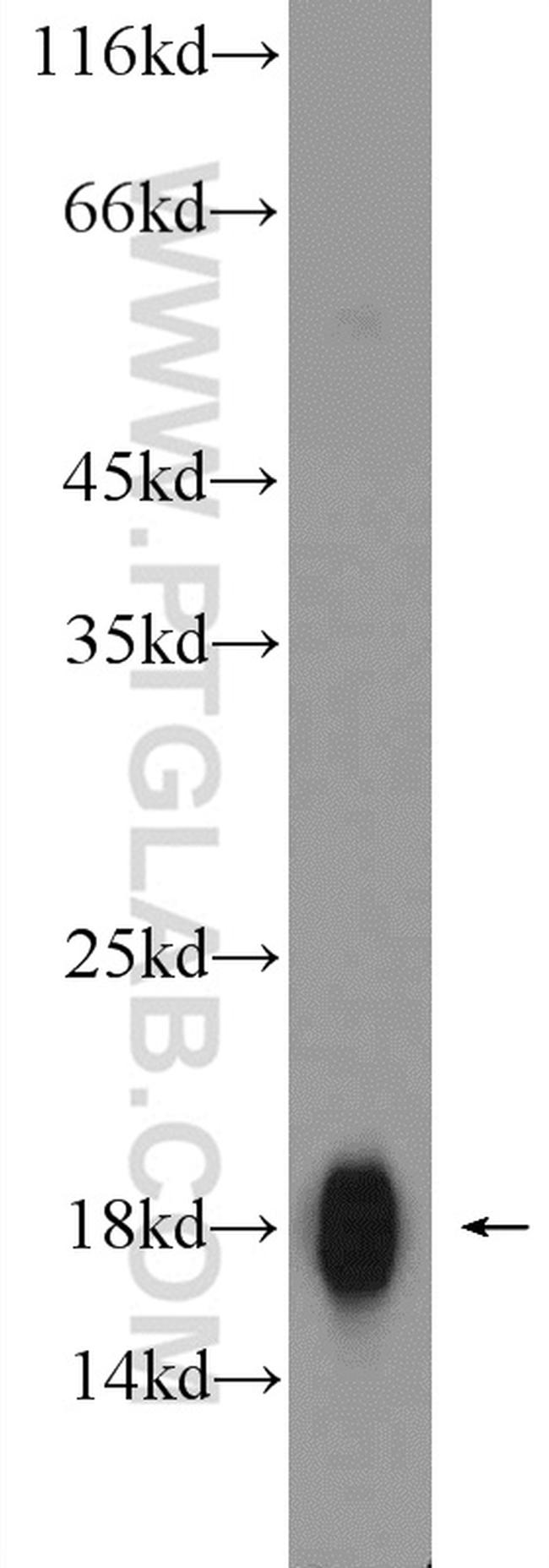 AGR2 Antibody in Western Blot (WB)