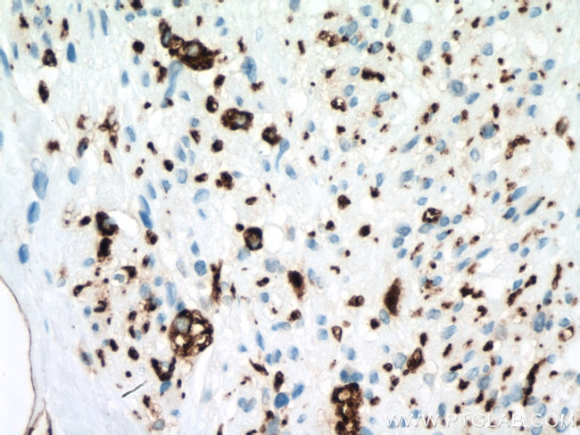 Calretinin Antibody in Immunohistochemistry (Paraffin) (IHC (P))